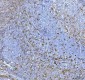 Anti-Fascin Monoclonal Antibody