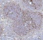 Anti-Fascin Monoclonal Antibody
