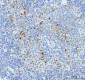 Anti-Fascin Monoclonal Antibody