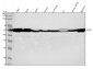 Anti-Fascin Monoclonal Antibody