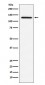 Anti-MDA5 Monoclonal Antibody