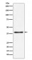 Anti-Aspartate Aminotransferase Monoclonal Antibody