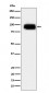 Anti-CD166 Monoclonal Antibody