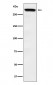 Anti-Huntingtin Monoclonal Antibody