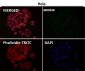 Anti-ZEB1 Monoclonal Antibody