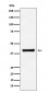 Anti-Aldolase ALDOA Monoclonal Antibody
