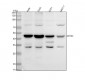 Anti-RRM2 Monoclonal Antibody