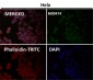 Anti-OGT Monoclonal Antibody