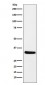 Anti-CRALBP RLBP1 Monoclonal Antibody