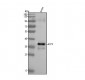 Anti-TRAP ACP5 Monoclonal Antibody