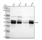 Anti-TRIB3 Monoclonal Antibody