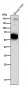 Anti-PMP70 ABCD3 Monoclonal Antibody