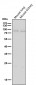 Anti-BDKRB2 Monoclonal Antibody