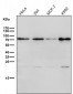 Anti-BDKRB2 Monoclonal Antibody