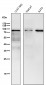 Anti-BDKRB2 Monoclonal Antibody