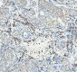 Anti-Neurokinin 1 Receptor Monoclonal Antibody