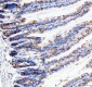 Anti-Neurokinin 1 Receptor Monoclonal Antibody
