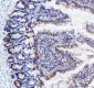 Anti-Neurokinin 1 Receptor Monoclonal Antibody
