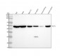 Anti-Neurokinin 1 Receptor Monoclonal Antibody