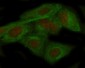 Anti-ADAR1 Monoclonal Antibody