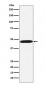 Anti-ACTL6A Monoclonal Antibody