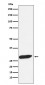 Anti-FHL1 Monoclonal Antibody