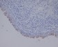 Anti-Uroplakin3a UPK3A Monoclonal Antibody