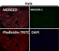 Anti-PODXL Monoclonal Antibody