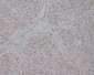 Anti-TFE3 Monoclonal Antibody