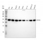 Anti-EIF4E Monoclonal Antibody