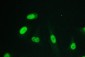Anti-RPA70 RPA1 Antibody Picoband™ (monoclonal, 11H4)