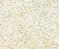 Anti-FH Antibody Picoband™ (monoclonal, 9D8)
