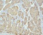 Anti-PPT1 Antibody Picoband™ (monoclonal, 10F3)