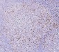 Anti-RAB27A Antibody Picoband™ (monoclonal, 2F5)
