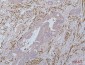 Anti-Desmin Antibody Picoband™ (monoclonal, 2B5)