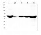 Anti-ALDH2 Antibody Picoband™ (monoclonal, 5G7)