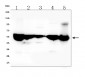 Anti-ALDH2 Antibody Picoband™ (monoclonal, 5G7)