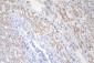 Anti-Tuberin TSC2 Antibody Picoband™ (monoclonal, 6I3)