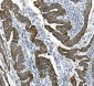 Anti-Cytokeratin 18 KRT18 Antibody Picoband™(monoclonal, 7I6)