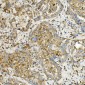 Anti-Hexokinase 1/HK1 Antibody Picoband™ (monoclonal, 2I4)