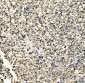 Anti-Hexokinase 1/HK1 Antibody Picoband™ (monoclonal, 2I4)