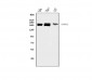Anti-SMARCA2/BRM Antibody Picoband™ (monoclonal, 3G3)