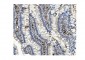 Anti-Methylmalonyl Coenzyme A mutase Antibody Picoband™ (monoclonal, 2D6)