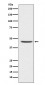 Anti-CCR8 Rabbit Monoclonal Antibody