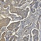 Anti-Aldolase/ALDOA Antibody Picoband™ (monoclonal, 6H8)