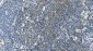 Anti-Carbonic Anhydrase I/CA1 Picoband™ Antibody (monoclonal, 2B5)