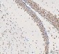 Anti-DDX1 Picoband™ Antibody (monoclonal, 3I10)