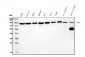 Anti-DDX1 Picoband™ Antibody (monoclonal, 2D4)