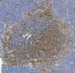 Anti- IL-17F Monoclonal Antibody