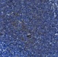 Anti- IL 17A Monoclonal Antibody